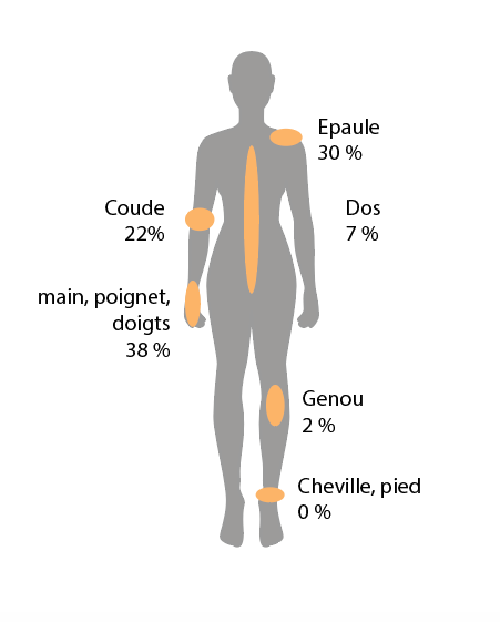 Améliorer l’ergonomie au travail